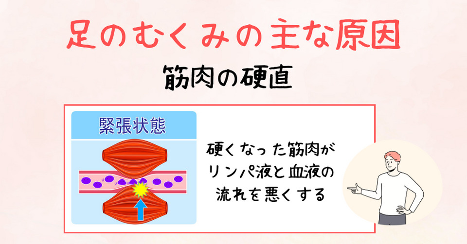 足のむくみの主な原因は筋肉の硬直。硬くなった筋肉が血管やリンパ菅を圧迫している。