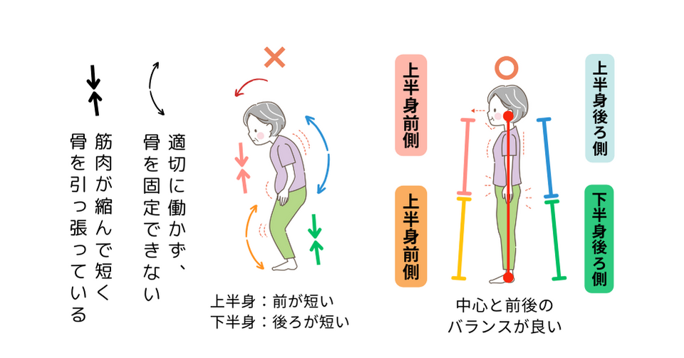 猫背・円背を治すための知識