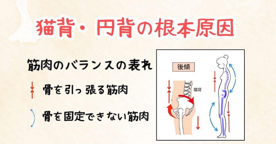 猫背・円背の原因