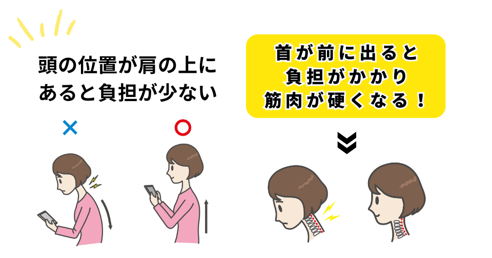 肩こり理由の根本的な原因は姿勢。頭の位置が肩の上にあると首や肩への負担は小さいが、前に出ると負担がかかり筋肉が緊張状態になるため肩こりになる。