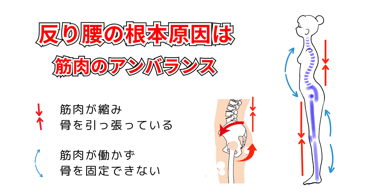 反り腰の根本原因